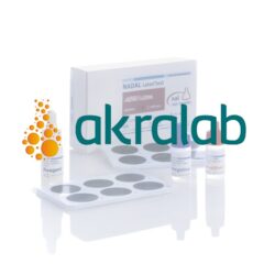 Test VDRL Látex en suero