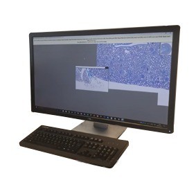 escaner-manual-portas-microvisionner