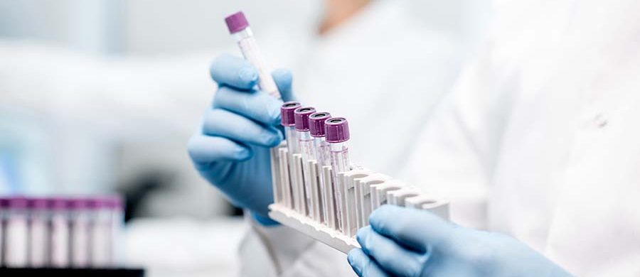 error qPCR detección COVID