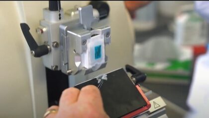 Soporte para cilindros de biopsias obtenidas por FNA BxChip - Imagen 3
