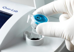 analizador-hemoglobina-glicosilada